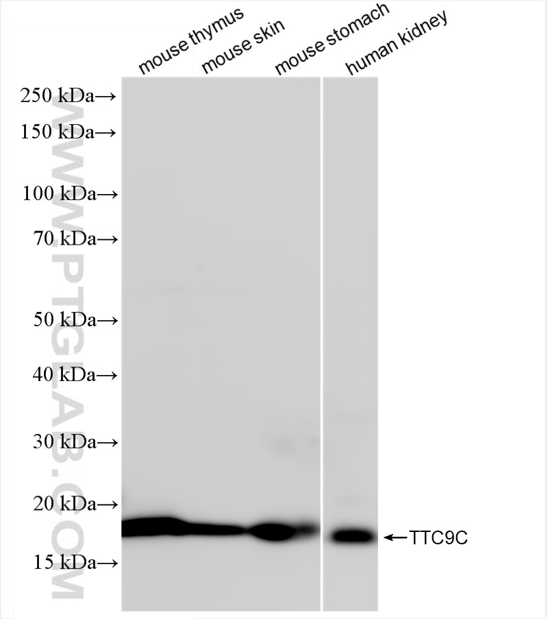 Western Blot (WB) analysis of various lysates using TTC9C Recombinant antibody (84611-2-RR)