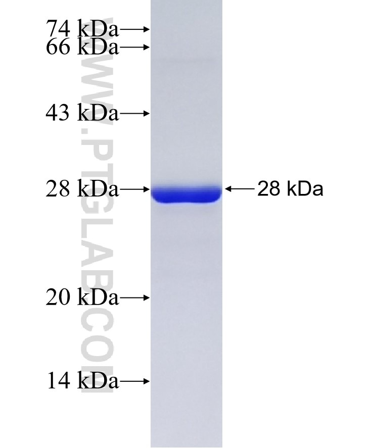 TTC9C fusion protein Ag37522 SDS-PAGE TTC9C fusion protein Ag37522 SDS-PAGE