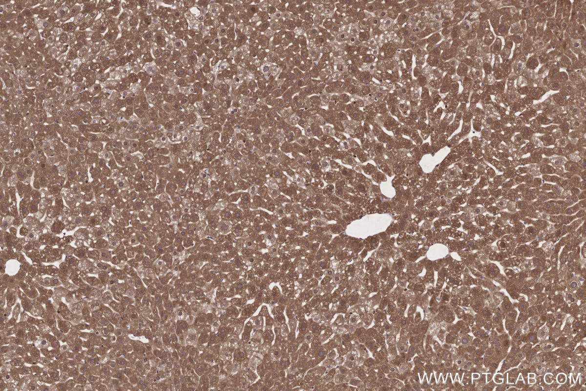 Immunohistochemistry (IHC) staining of mouse liver tissue using TTDN1 Polyclonal antibody (25410-1-AP)