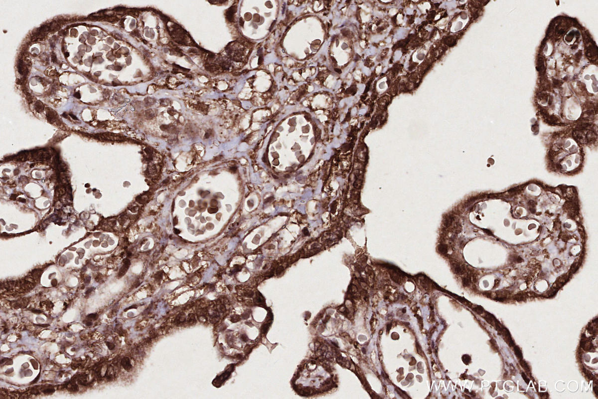 Immunohistochemistry (IHC) staining of human placenta tissue using TTDN1 Polyclonal antibody (25410-1-AP)