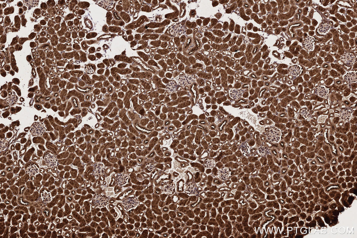 Immunohistochemistry (IHC) staining of mouse kidney tissue using TTDN1 Polyclonal antibody (25410-1-AP)