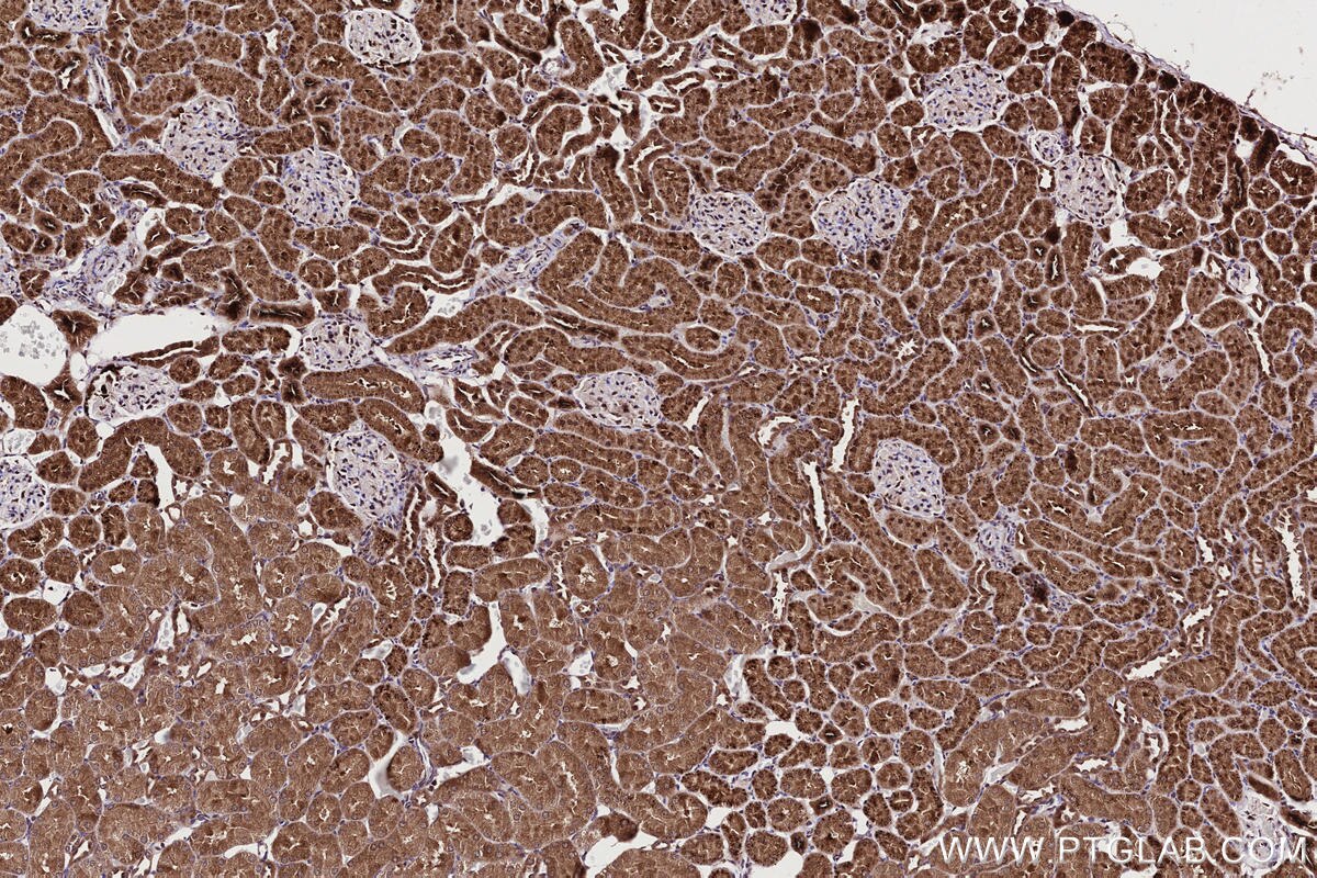 Immunohistochemistry (IHC) staining of rat kidney tissue using TTDN1 Polyclonal antibody (25410-1-AP)