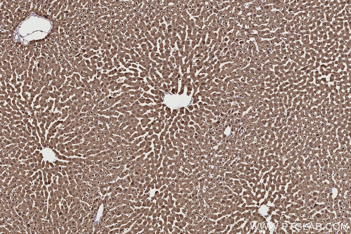 Immunohistochemistry (IHC) staining of rat liver tissue using TTDN1 Polyclonal antibody (25410-1-AP)