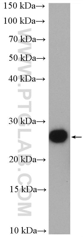 Western Blot (WB) analysis of NIH/3T3 cells using TTDN1 Polyclonal antibody (25410-1-AP)