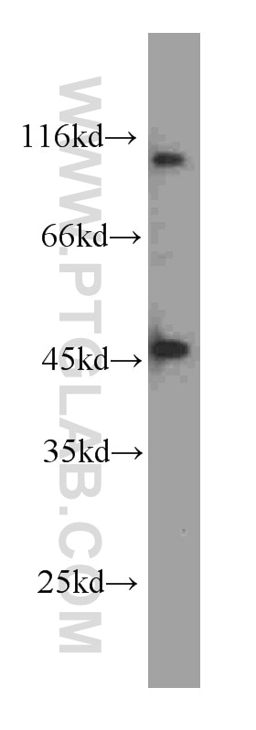 Western Blot (WB) analysis of HeLa cells using transcription termination factor-Specific Monoclon (60235-1-Ig)