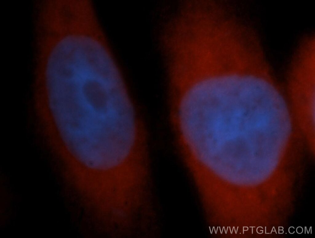 Immunofluorescence (IF) / fluorescent staining of HeLa cells using TTF2 Polyclonal antibody (13722-1-AP)