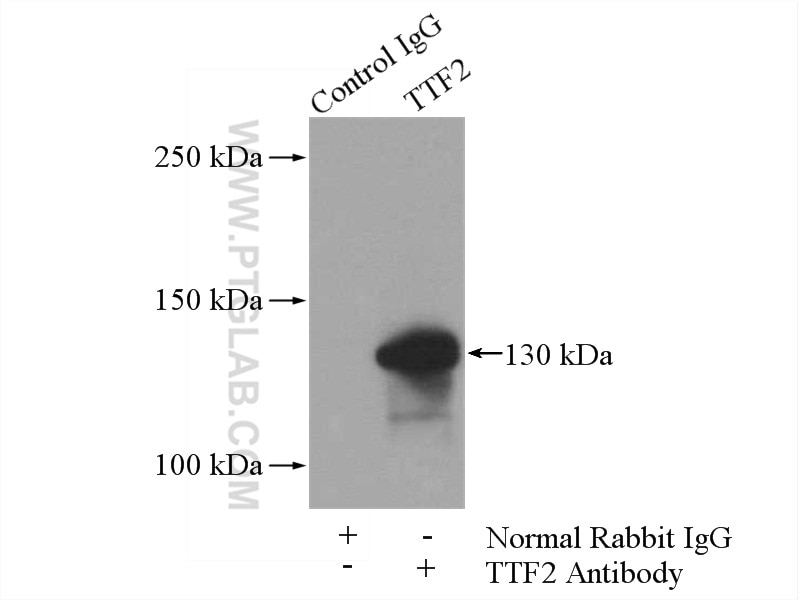 Immunoprecipitation (IP) experiment of A2780 cells using TTF2 Polyclonal antibody (13722-1-AP)