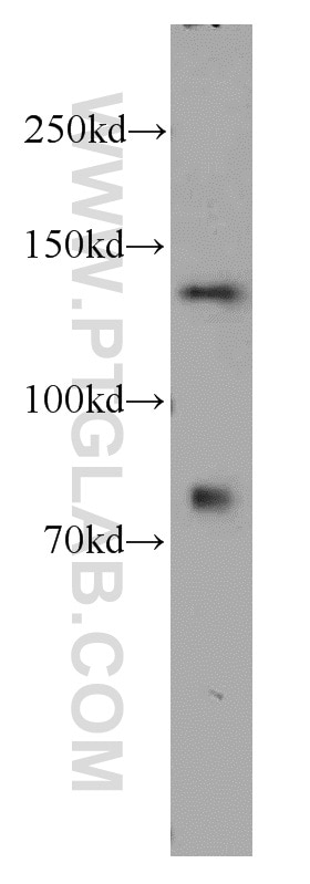 Western Blot (WB) analysis of A2780 cells using TTF2 Polyclonal antibody (13722-1-AP)