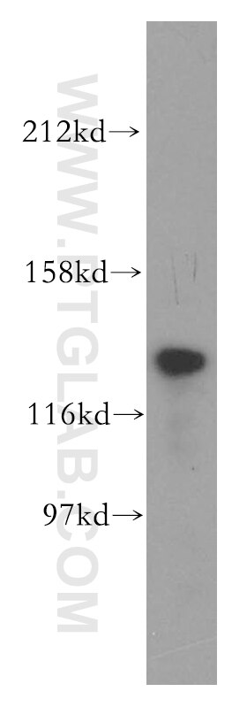 Western Blot (WB) analysis of A2780 cells using TTF2 Polyclonal antibody (13722-1-AP)