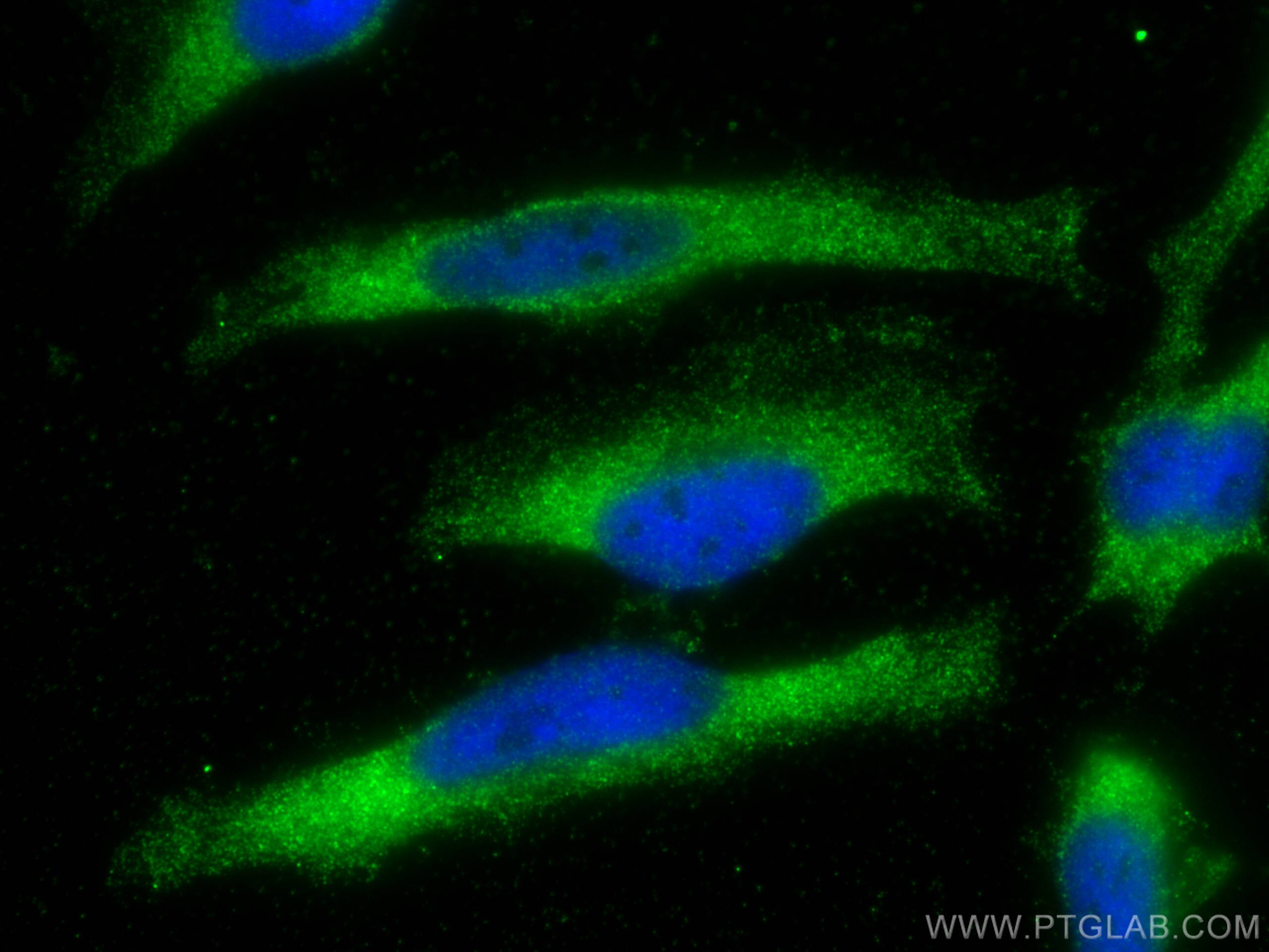 Immunofluorescence (IF) / fluorescent staining of HeLa cells using TTK Polyclonal antibody (10381-1-AP)