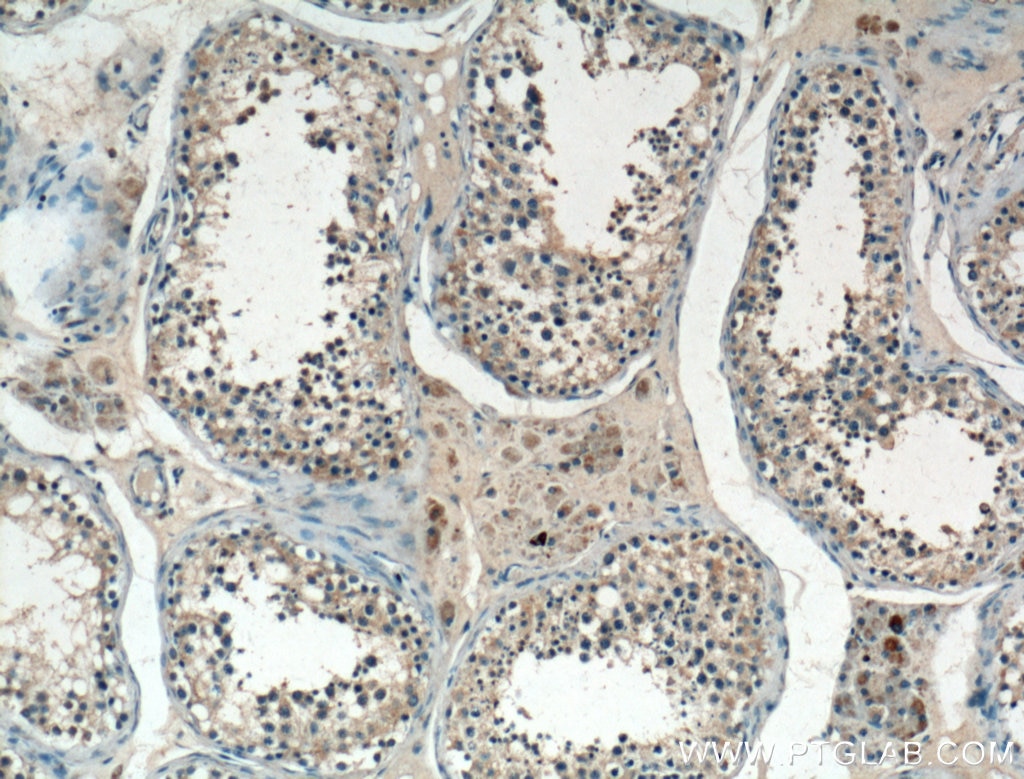 Immunohistochemistry (IHC) staining of human testis tissue using TTK Polyclonal antibody (10381-1-AP)