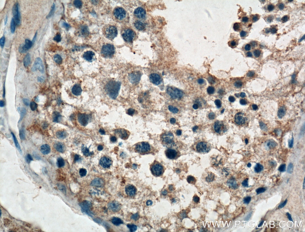 Immunohistochemistry (IHC) staining of human testis tissue using TTK Polyclonal antibody (10381-1-AP)
