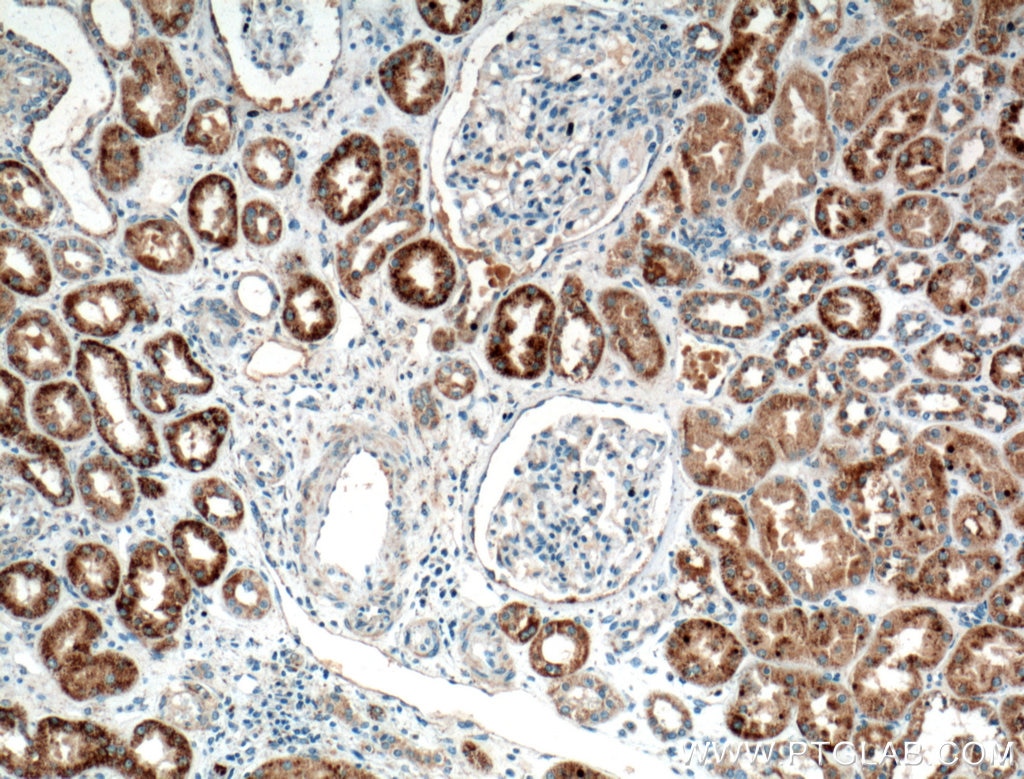 Immunohistochemistry (IHC) staining of human kidney tissue using TTK Polyclonal antibody (10381-1-AP)