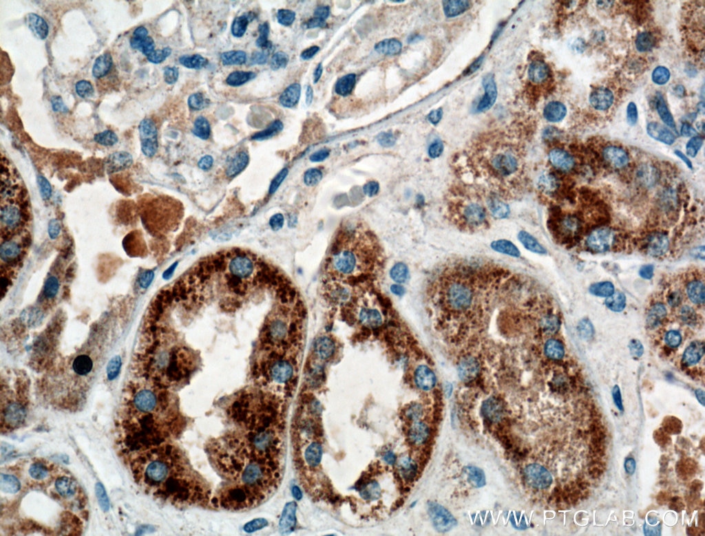 Immunohistochemistry (IHC) staining of human kidney tissue using TTK Polyclonal antibody (10381-1-AP)