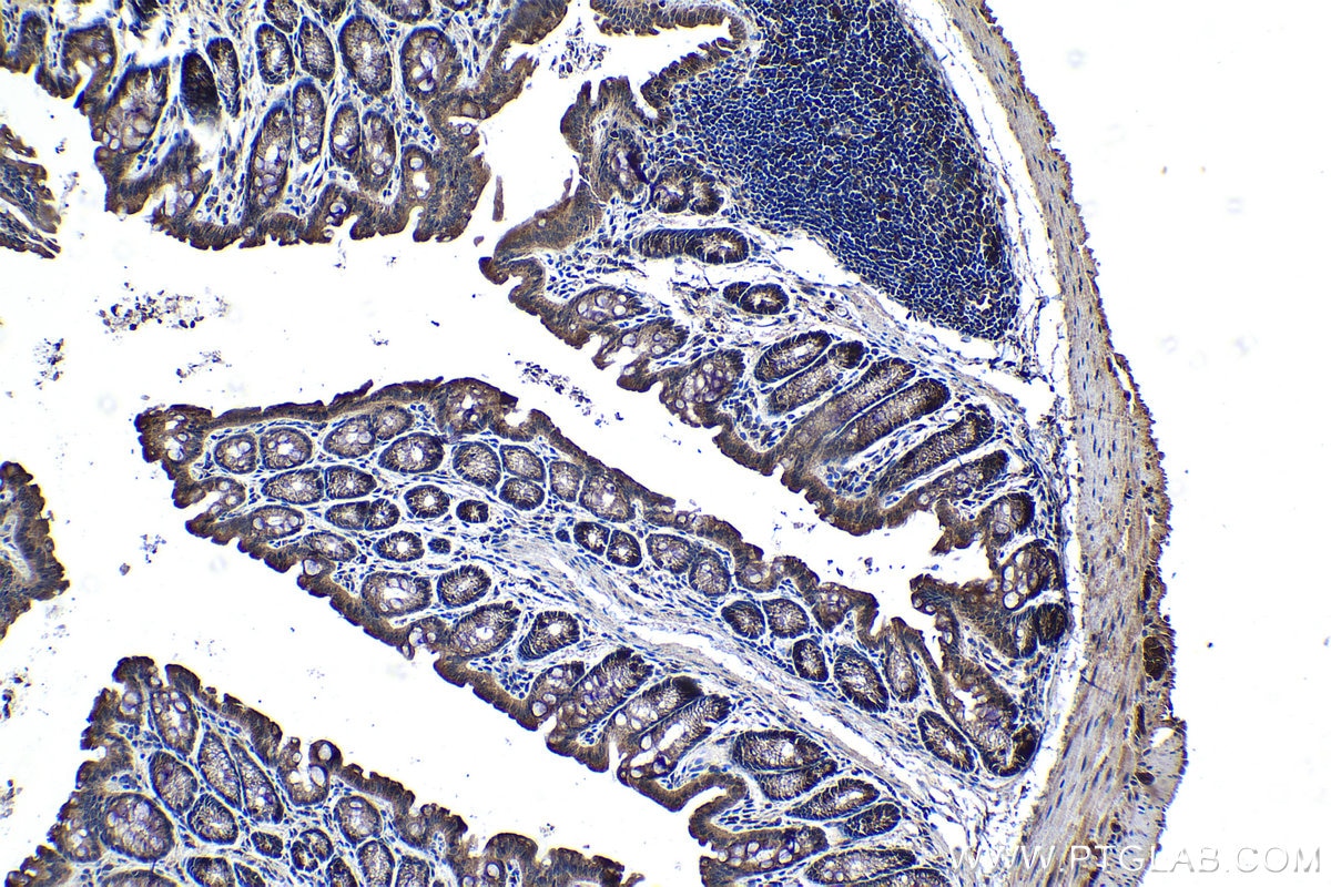 Immunohistochemistry (IHC) staining of mouse colon tissue using TTK Polyclonal antibody (10381-1-AP)