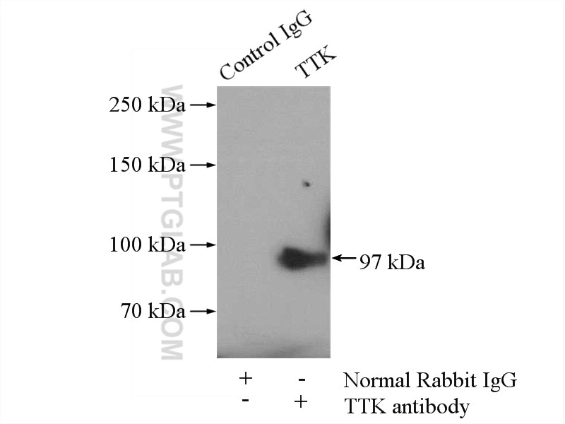 Immunoprecipitation (IP) experiment of MDA-MB-453s cells using TTK Polyclonal antibody (10381-1-AP)