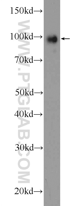 WB analysis of MCF-7 using 10381-1-AP