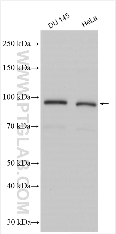 Western Blot (WB) analysis of various lysates using TTK Polyclonal antibody (10381-1-AP)
