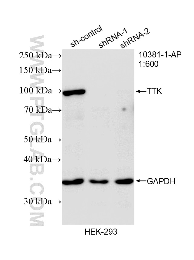 Western Blot (WB) analysis of HEK-293 cells using TTK Polyclonal antibody (10381-1-AP)