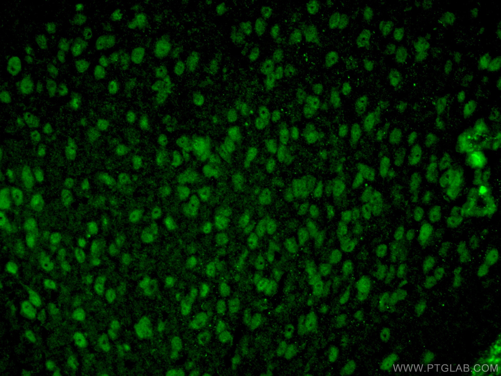 Immunofluorescence (IF) / fluorescent staining of mouse brain tissue using TTL Polyclonal antibody (13618-1-AP)