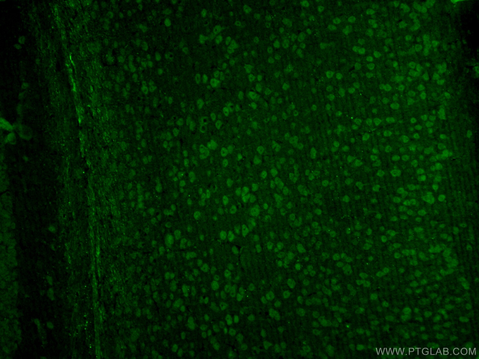 IF Staining of mouse brain using 13618-1-AP