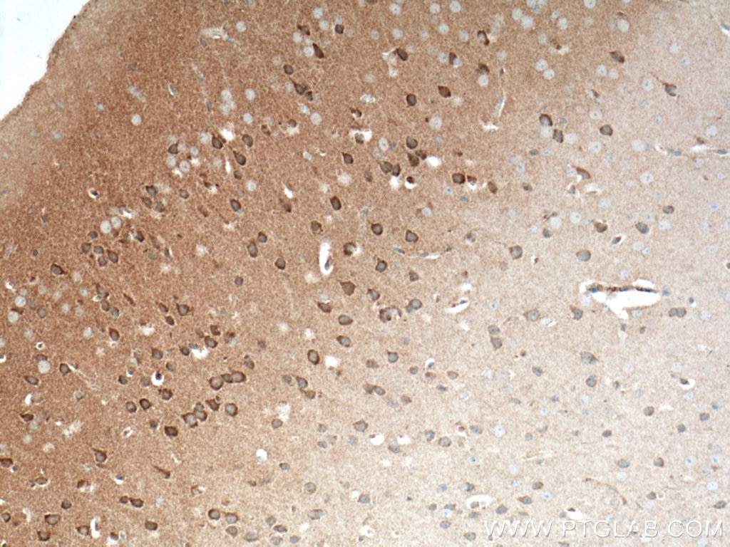 Immunohistochemistry (IHC) staining of mouse brain tissue using TTL Polyclonal antibody (13618-1-AP)