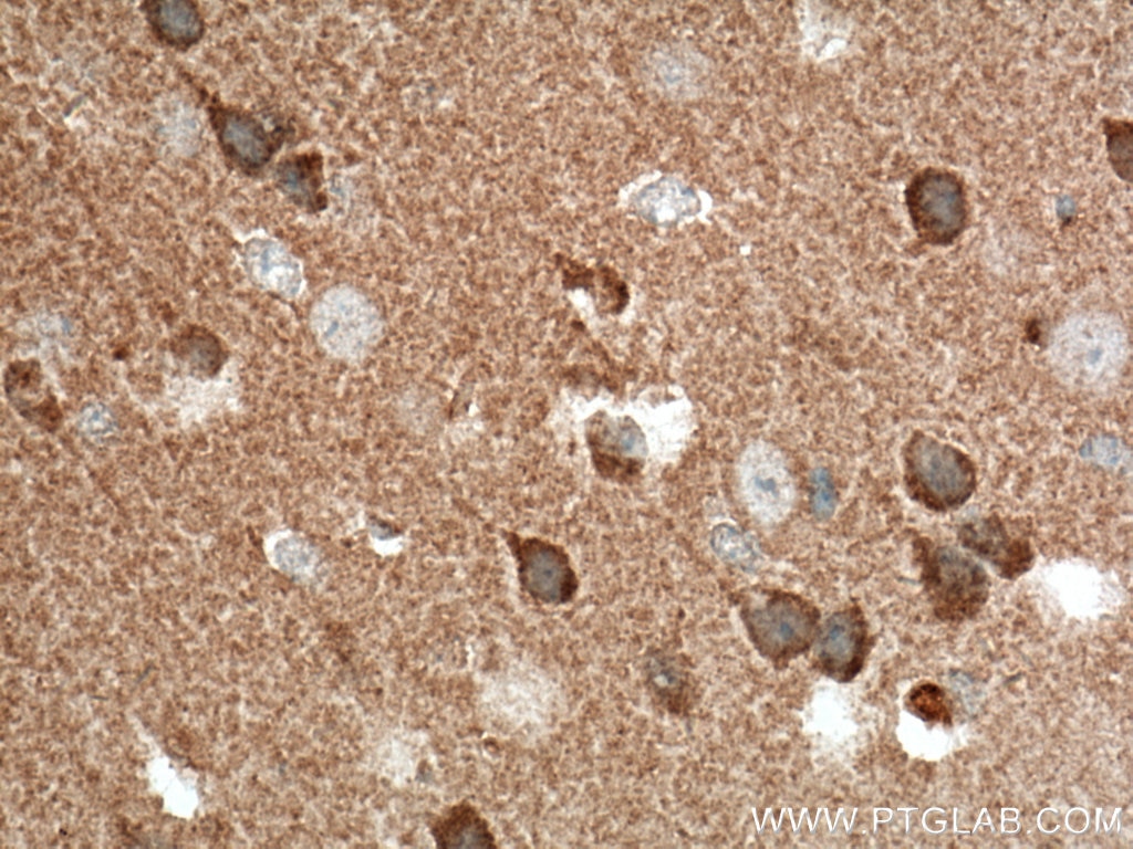 Immunohistochemistry (IHC) staining of mouse brain tissue using TTL Polyclonal antibody (13618-1-AP)