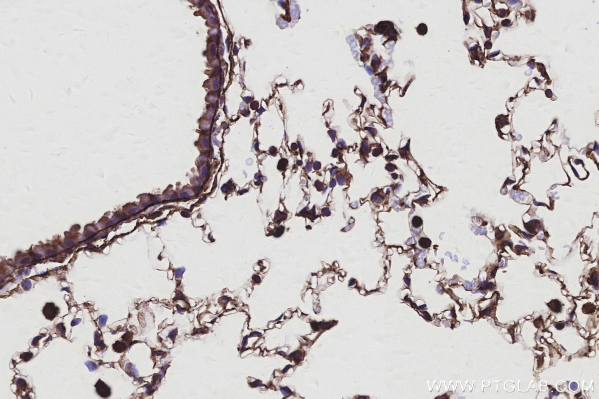 Immunohistochemistry (IHC) staining of mouse lung tissue using TTL Polyclonal antibody (13618-1-AP)
