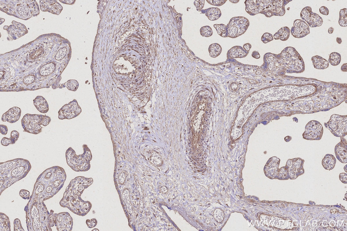 Immunohistochemistry (IHC) staining of human placenta tissue using TTL Polyclonal antibody (13618-1-AP)