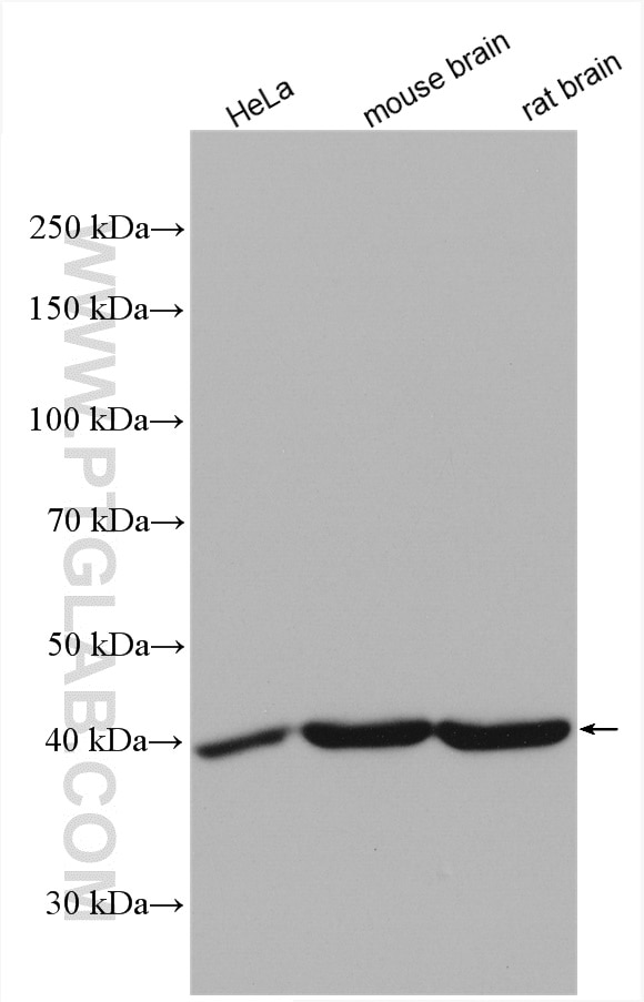 Western Blot (WB) analysis of various lysates using TTL Polyclonal antibody (13618-1-AP)