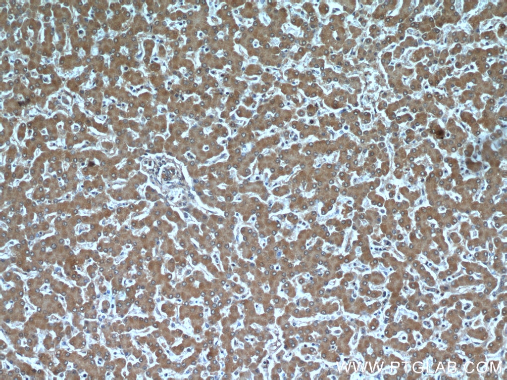 Immunohistochemistry (IHC) staining of human liver tissue using TTL Monoclonal antibody (66076-1-Ig)