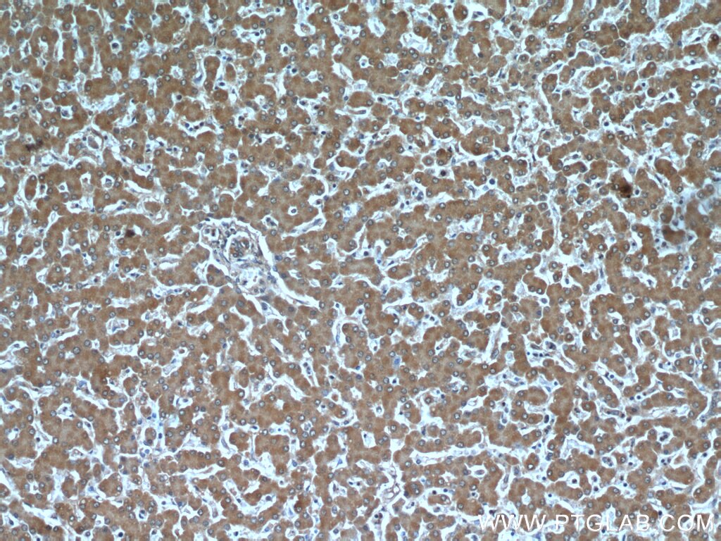 IHC staining of human liver using 66076-1-Ig