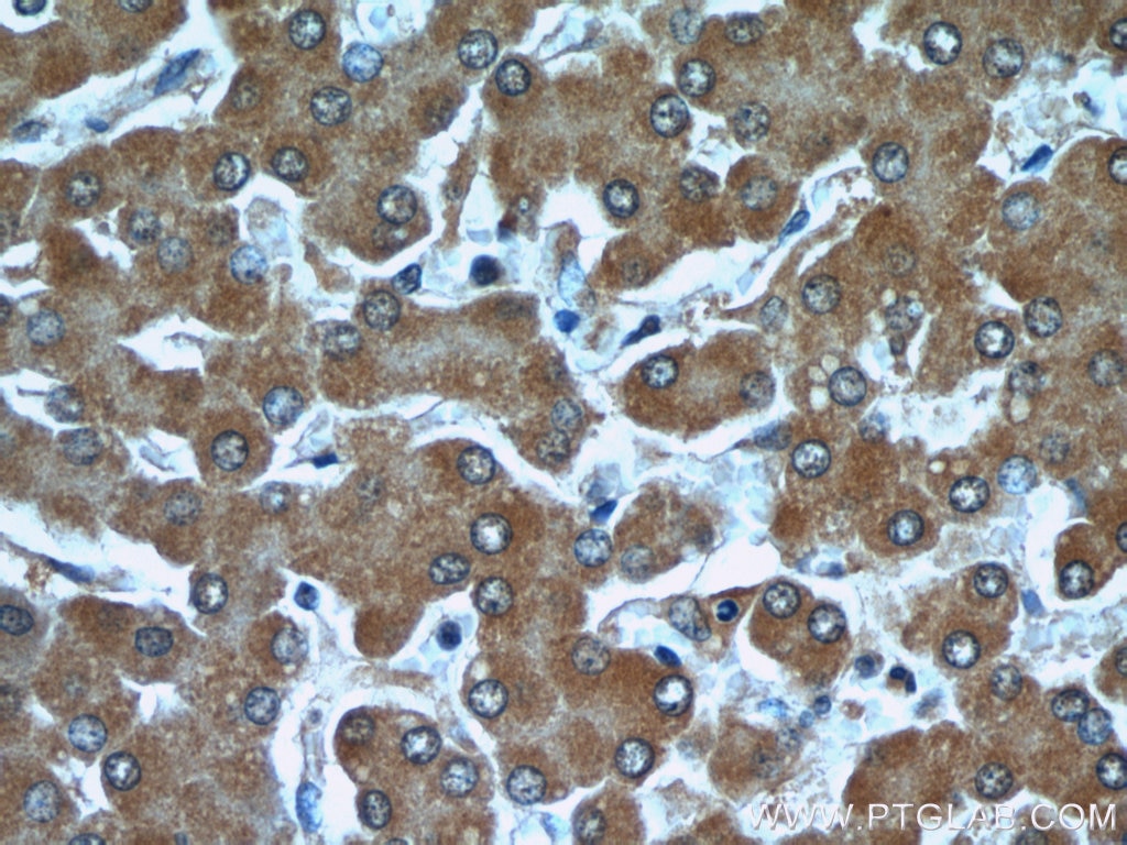 Immunohistochemistry (IHC) staining of human liver tissue using TTL Monoclonal antibody (66076-1-Ig)