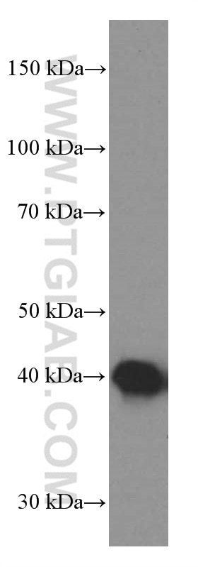 Western Blot (WB) analysis of fetal human brain tissue using TTL Monoclonal antibody (66076-1-Ig)