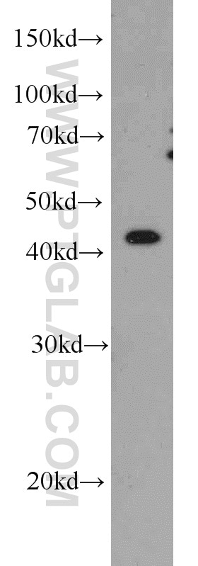 Western Blot (WB) analysis of SH-SY5Y cells using TTL Monoclonal antibody (66076-1-Ig)