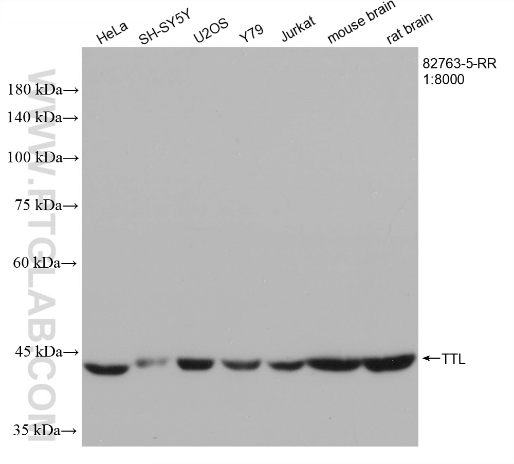 Western Blot (WB) analysis of various lysates using TTL Recombinant antibody (82763-5-RR)