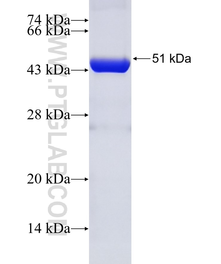 TTL fusion protein Ag4708 SDS-PAGE
