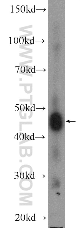 Western Blot (WB) analysis of rat testis tissue using TTLL10 Polyclonal antibody (26014-1-AP)