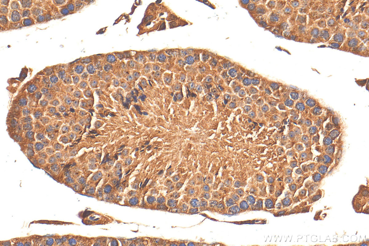 Immunohistochemistry (IHC) staining of mouse testis tissue using TTLL12 Polyclonal antibody (21447-1-AP)