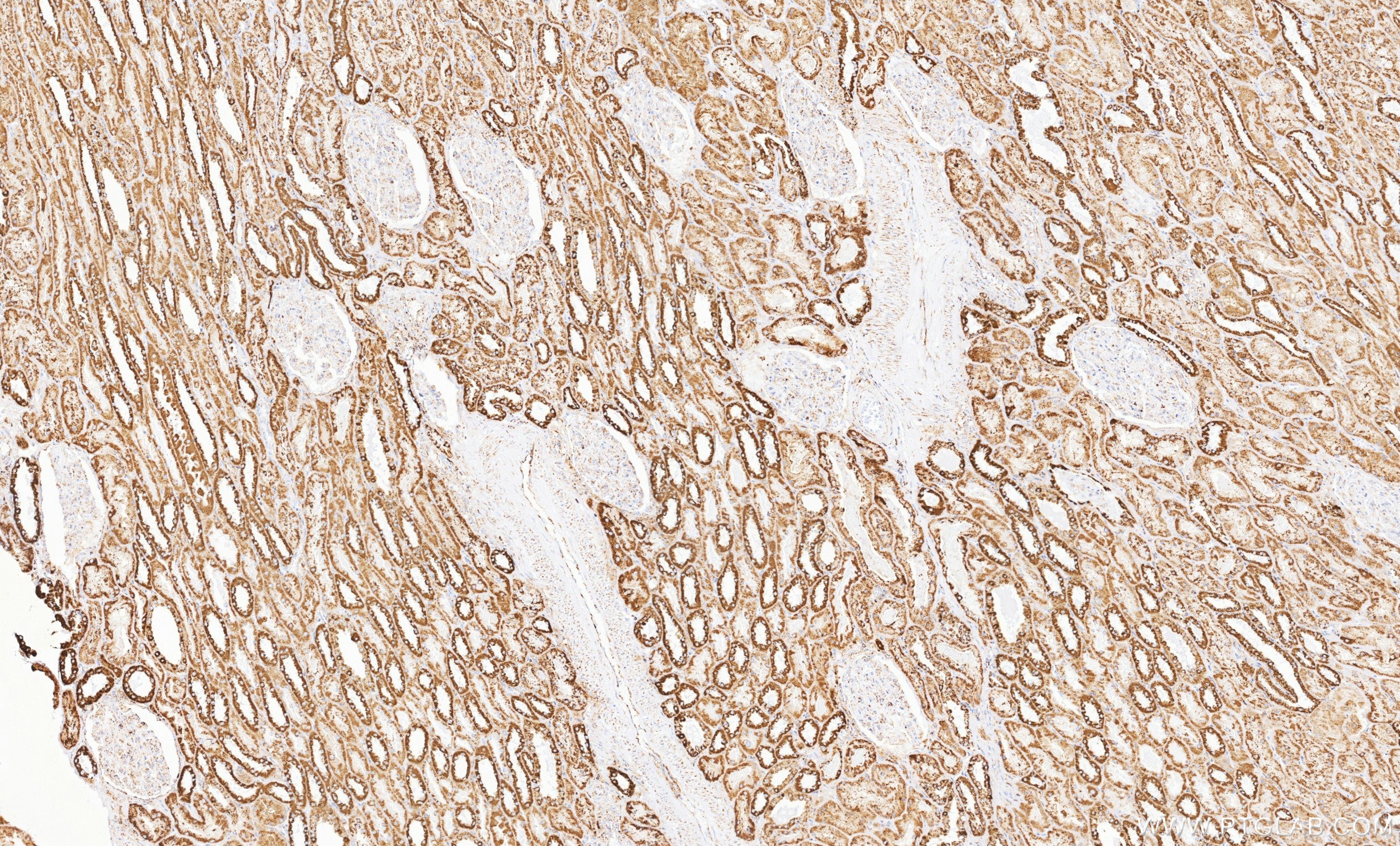 Immunohistochemistry (IHC) staining of human kidney tissue using TTLL12 Recombinant monoclonal antibody (84493-6-RR)