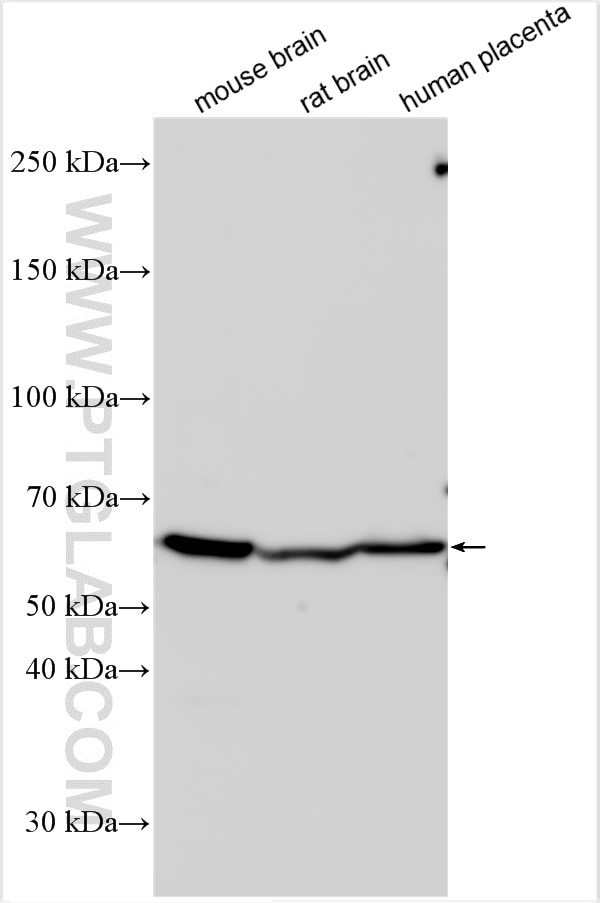 Western Blot (WB) analysis of various lysates using TTLL2 Polyclonal antibody (23988-1-AP)