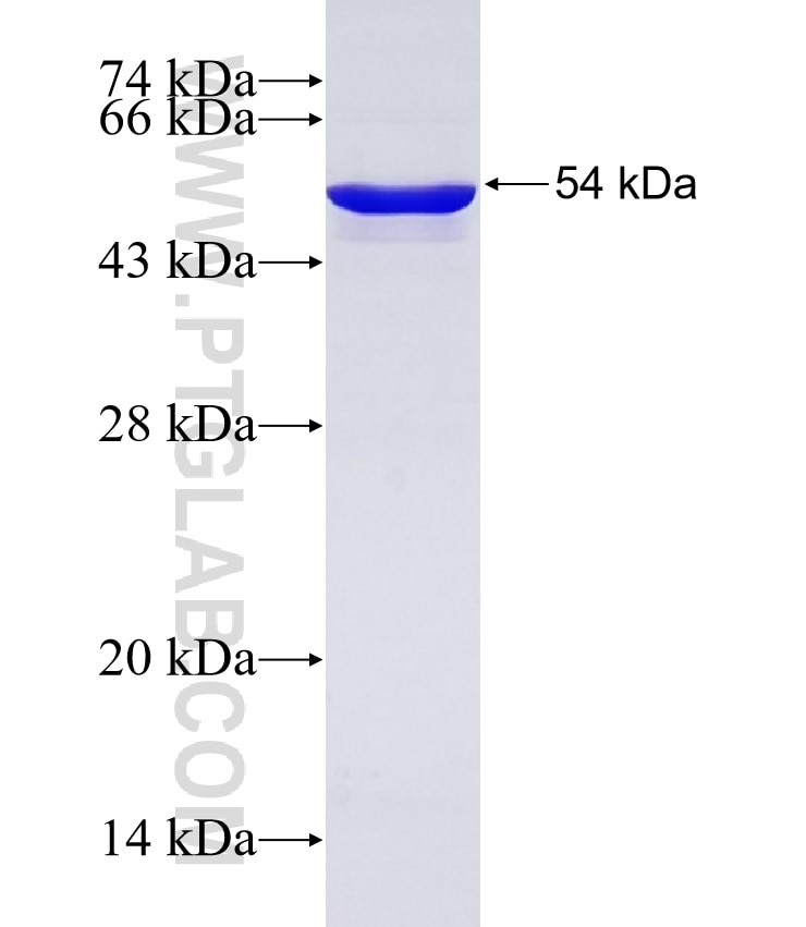 TTN fusion protein Ag27496 SDS-PAGE