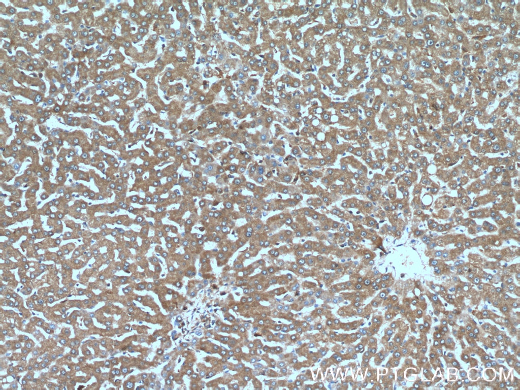 Immunohistochemistry (IHC) staining of human liver tissue using TTPA Polyclonal antibody (27081-1-AP)