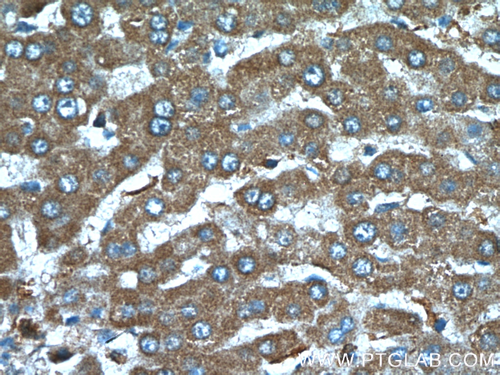 Immunohistochemistry (IHC) staining of human liver tissue using TTPA Polyclonal antibody (27081-1-AP)