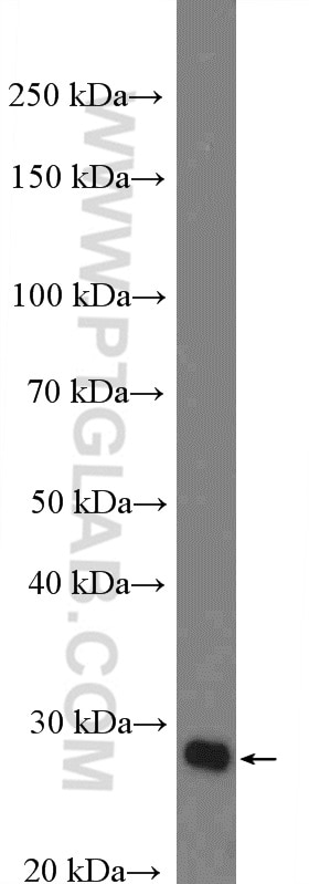 WB analysis of mouse liver using 27081-1-AP