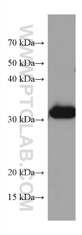 Western Blot (WB) analysis of rat liver tissue using TTPA Monoclonal antibody (67431-1-Ig)