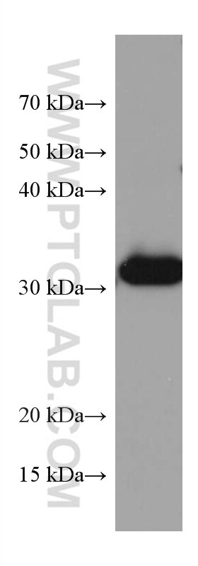 WB analysis of rat liver using 67431-1-Ig