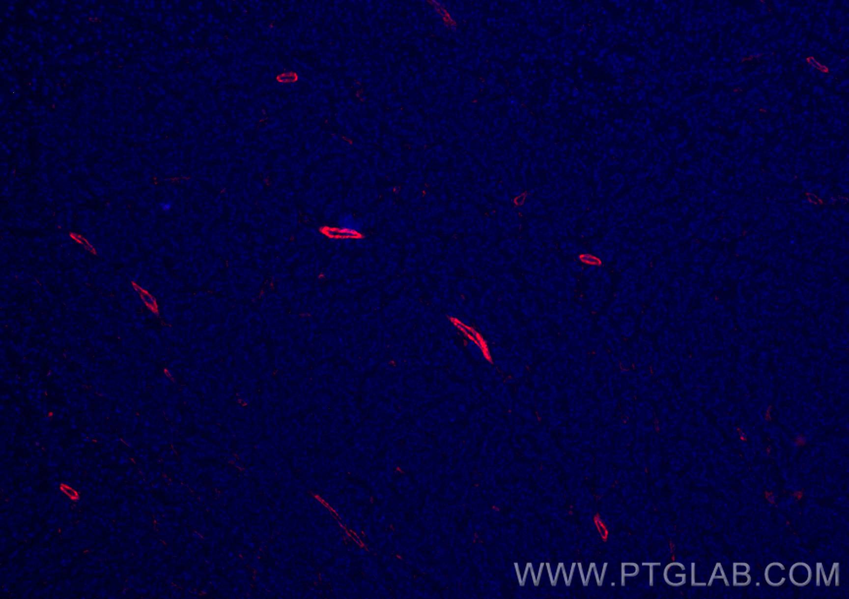 IF Staining of human liver cancer using CL594-67431