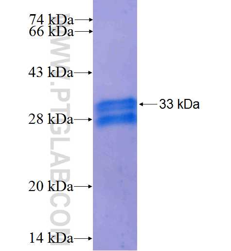 TTPA fusion protein Ag24177 SDS-PAGE