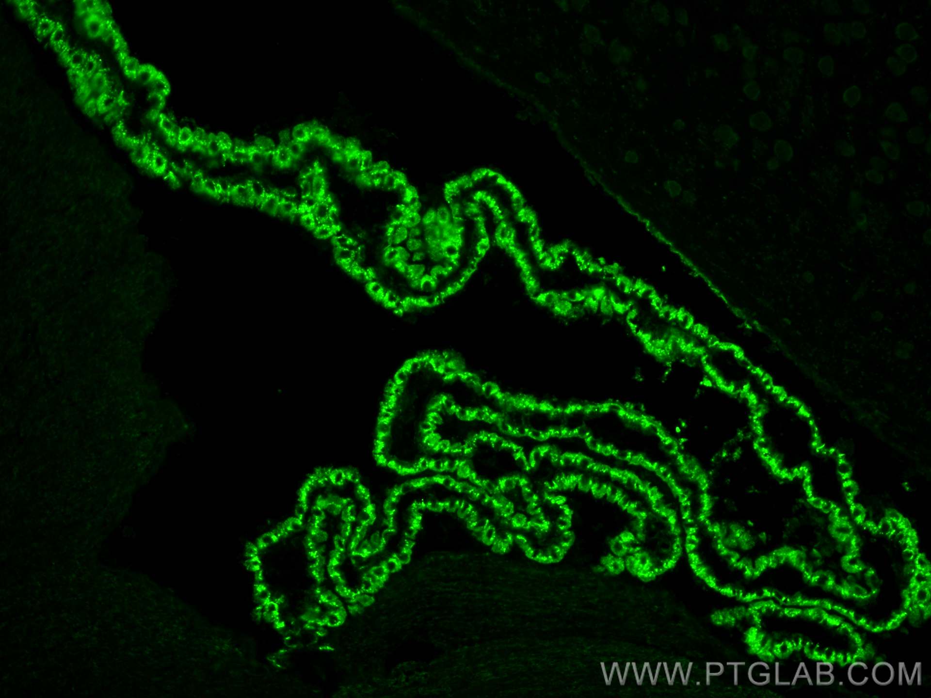 Immunofluorescence (IF) / fluorescent staining of mouse brain tissue using human Prealbumin/transthyretin Polyclonal antibody (11891-1-AP)